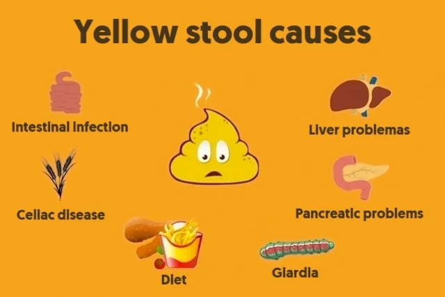 Yellow Balls in Stool- Main Causes & things to do